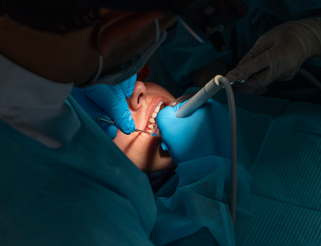 La-chirurgie-gingivale